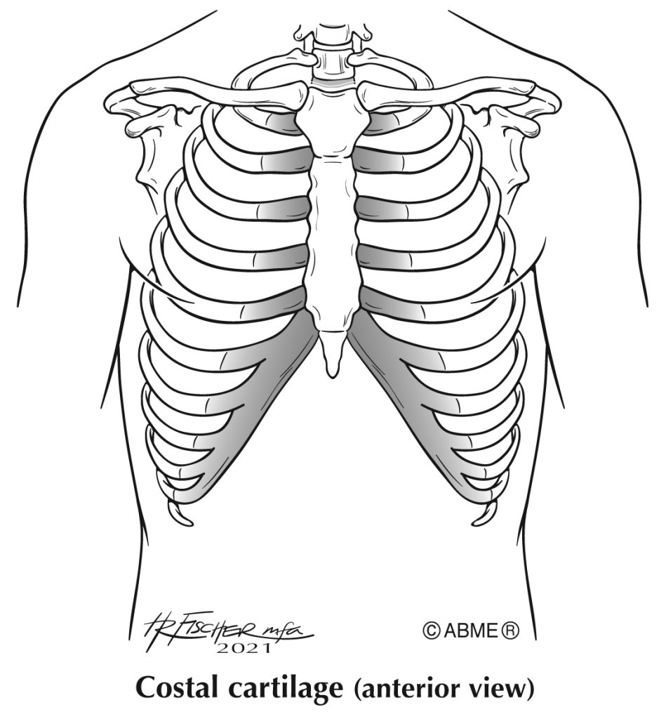 Proj #46 Costal cartilage muscles